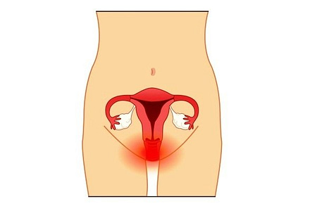Survival Rate of Uterine Cancer