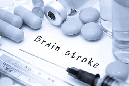 What to Do if You See Someone Getting a Stroke?